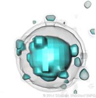 Sphere_SaltAndPepper