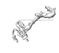 aneurism_subregion_result