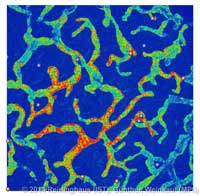 lymph_manually_selected_extrema