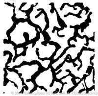 lymph_segmentation_our